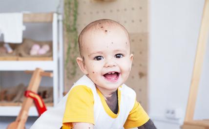 У десятимесячного Демида может развиться меланома кожи. Срочно нужна помощь! У десятимесячного Демида может развиться меланома кожи. Срочно нужна помощь!