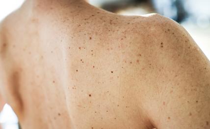 «Это шок»: Названа объединяющая 30-летних деталь во внешности «Это шок»: Названа объединяющая 30-летних деталь во внешности