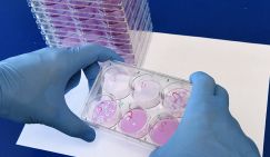 Врач усомнился в утверждении главы ВОЗ об искусственном происхождении ковида