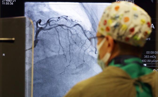 Ученые нашли способ снизить риск инсульта