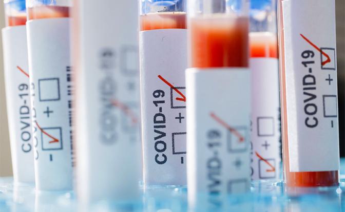 Названо число жертв коронавируса в России за сутки