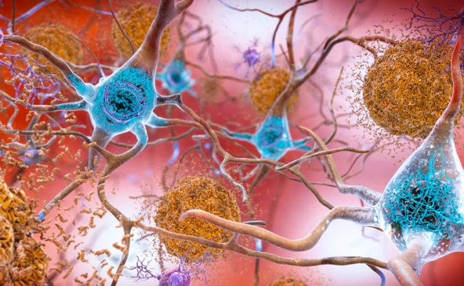 Назван способ подавить болезнь Альцгеймера