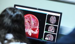 Прорыв китайских ученых: наноботы избавят человечество от опухолей мозга и аневризмы
