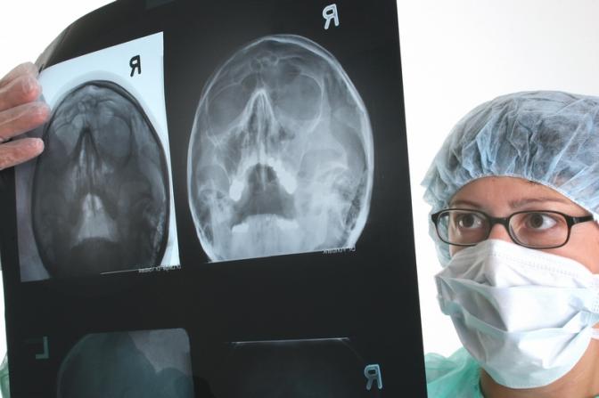 Ученые: У миллениалов выросла заболеваемость раком