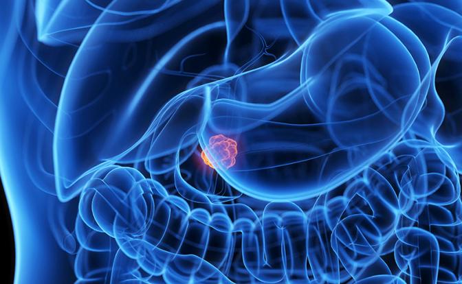 Врач назвал три сигнала разрушения поджелудочной Врач назвал три сигнала разрушения поджелудочной