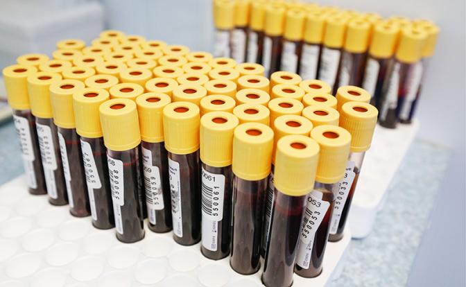 В районе Башкирии объявили о критической ситуации с ВИЧ: инфекция есть даже у призывников