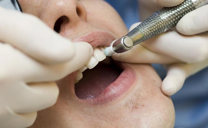 Врач рассказала, о чём может сигнализировать налёт на зубах