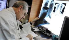 Врач-онколог объяснила, зачем проверять лёгкие после ковида