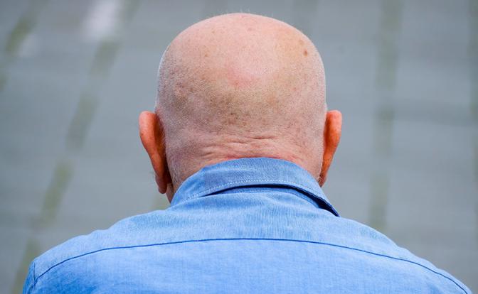 Известное растение оказалось связано с замедлением облысения