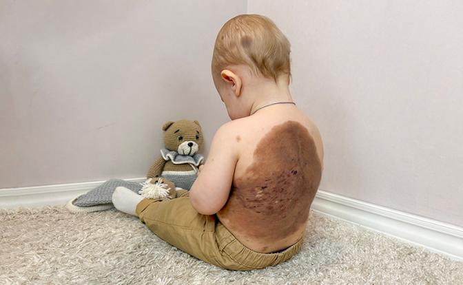 «Я чувствовала стыд и страх»: Как родители годовалого Миши борются за его право на жизнь