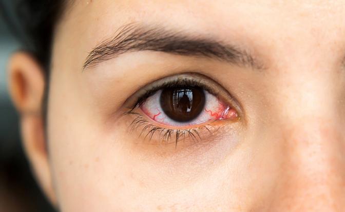 Зрение под защитой: врач раскрыла секрет полезных для глаз продуктов