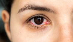 Зрение под защитой: врач раскрыла секрет полезных для глаз продуктов