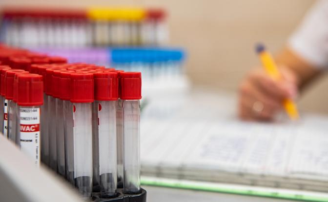 Стало известно, сколько раз в год нужно сдавать кровь