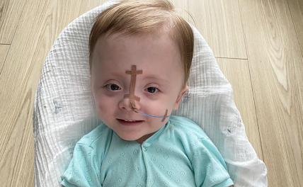 Мочеполовая система и кишечник Радимира срослись в один канал