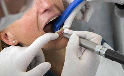 Стоматолог удалила пациентке 22 здоровых зуба из-за денег