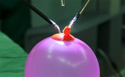 Китайский врач режет корку мандарина на воздушном шаре с помощью робота